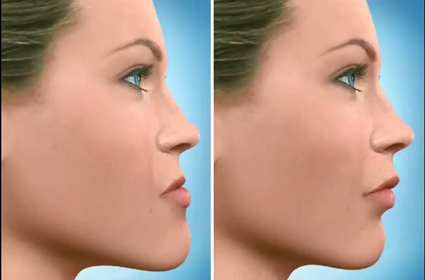 【美品】アトラス 顎顔面矯正 顎変形症と口唇口蓋裂の矯正治療 美品】アトラス 顎顔面矯正 顎変形症と口唇口蓋裂の矯正治療